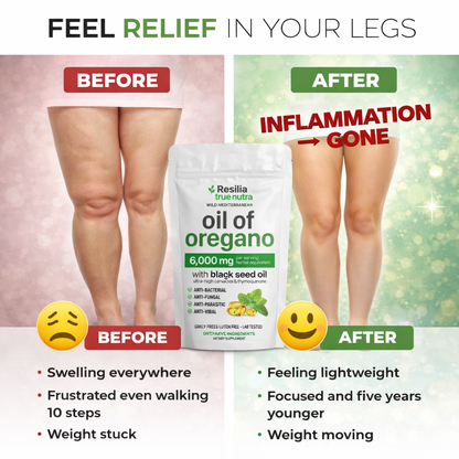 TRUE NUTRA OREGANO OIL ®